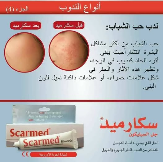 Scarmed creme