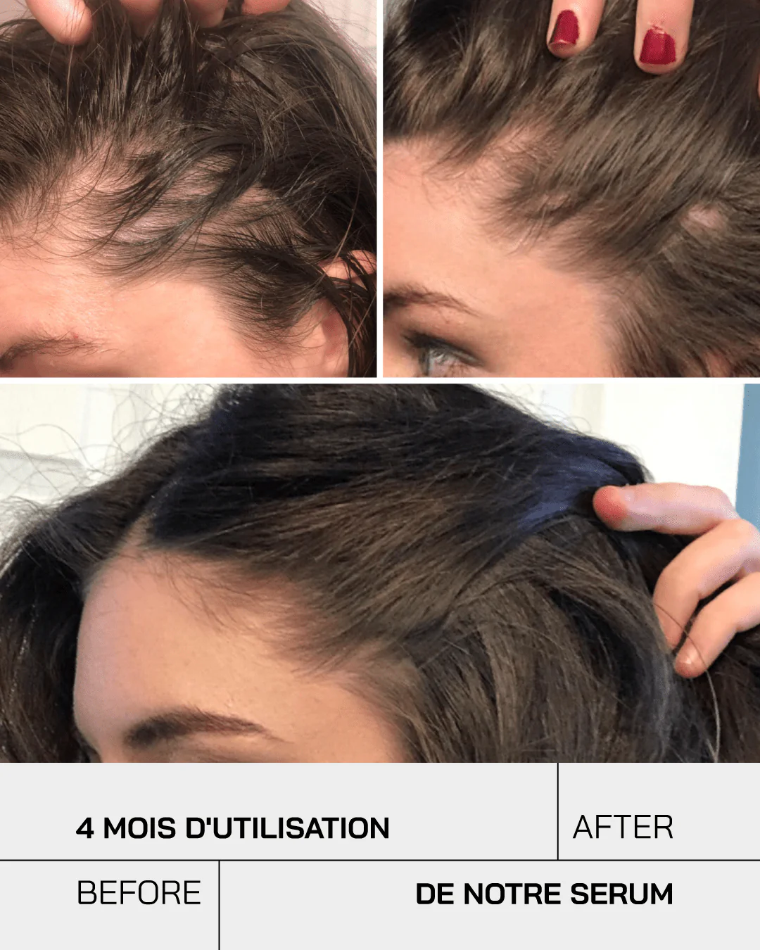 Touché Sérum Anti-Chute De Cheveux 50 ml 