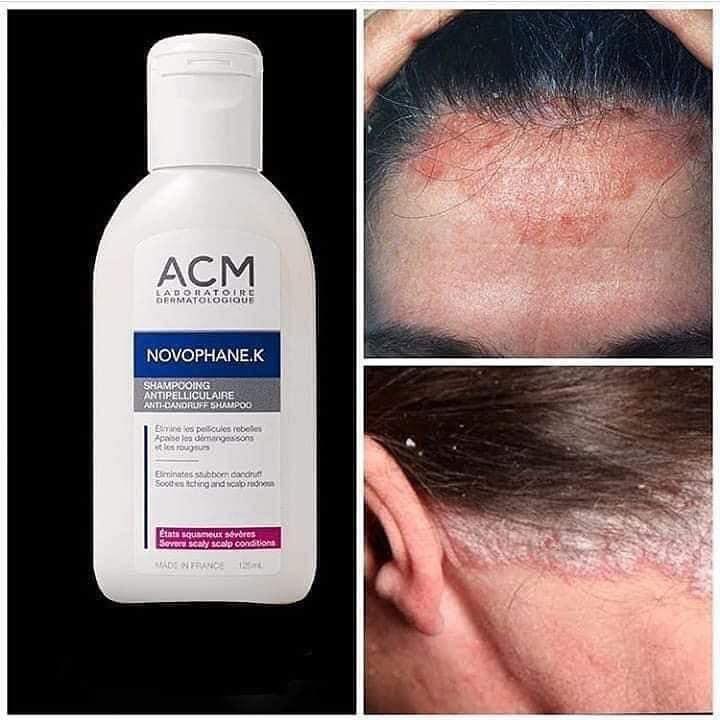 novophane K shampoing  antipelliculaire 